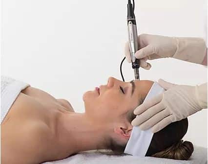 Dermapen