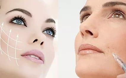 Mesoterapia
